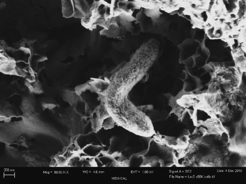 high resolution image of sulfate-reducing microbe in biofilm on the surface of a corroding steel sample.