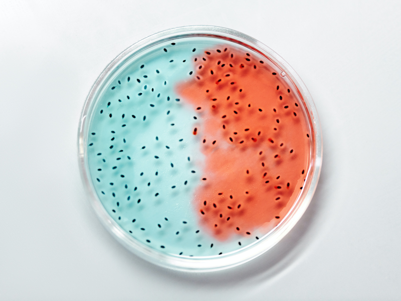 Photo of microorganisms in a petri dish